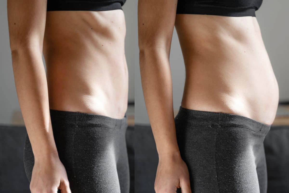 How long does diastasis recti take to improve Orpington?
