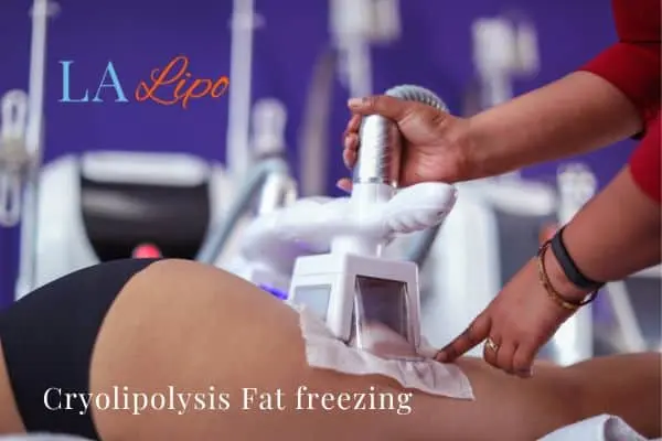 women getting fat freezing Orpington
