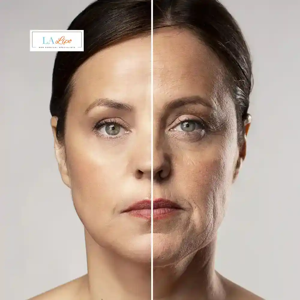 How Can You Tell If Non-Surgical Skin Tightening Is Right for You Orpington?