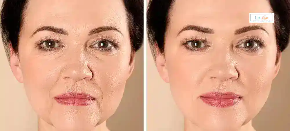 Why Aren’t My Skincare Products Making My Sagging Skin Look Firmer Orpington?