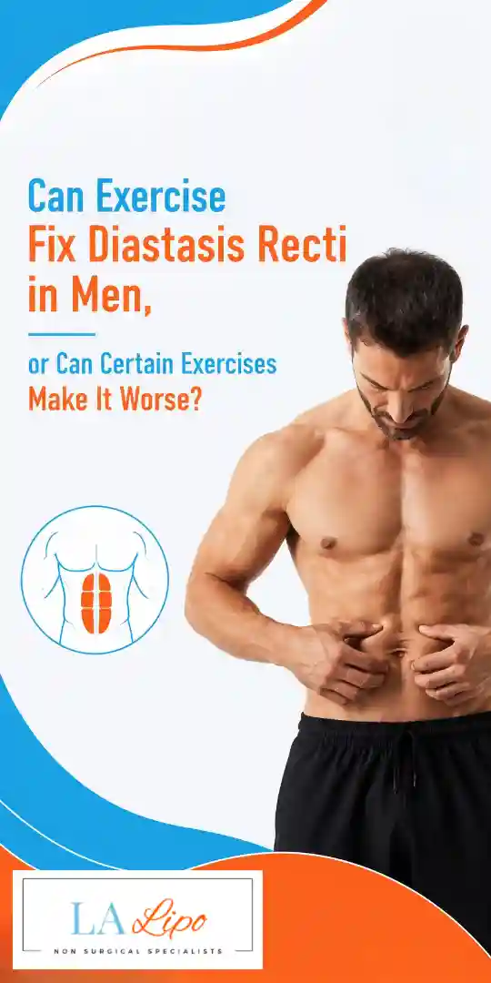 Can Exercise Fix Diastasis Recti in Men, or Can Certain Exercises Make It Worse Orpington?