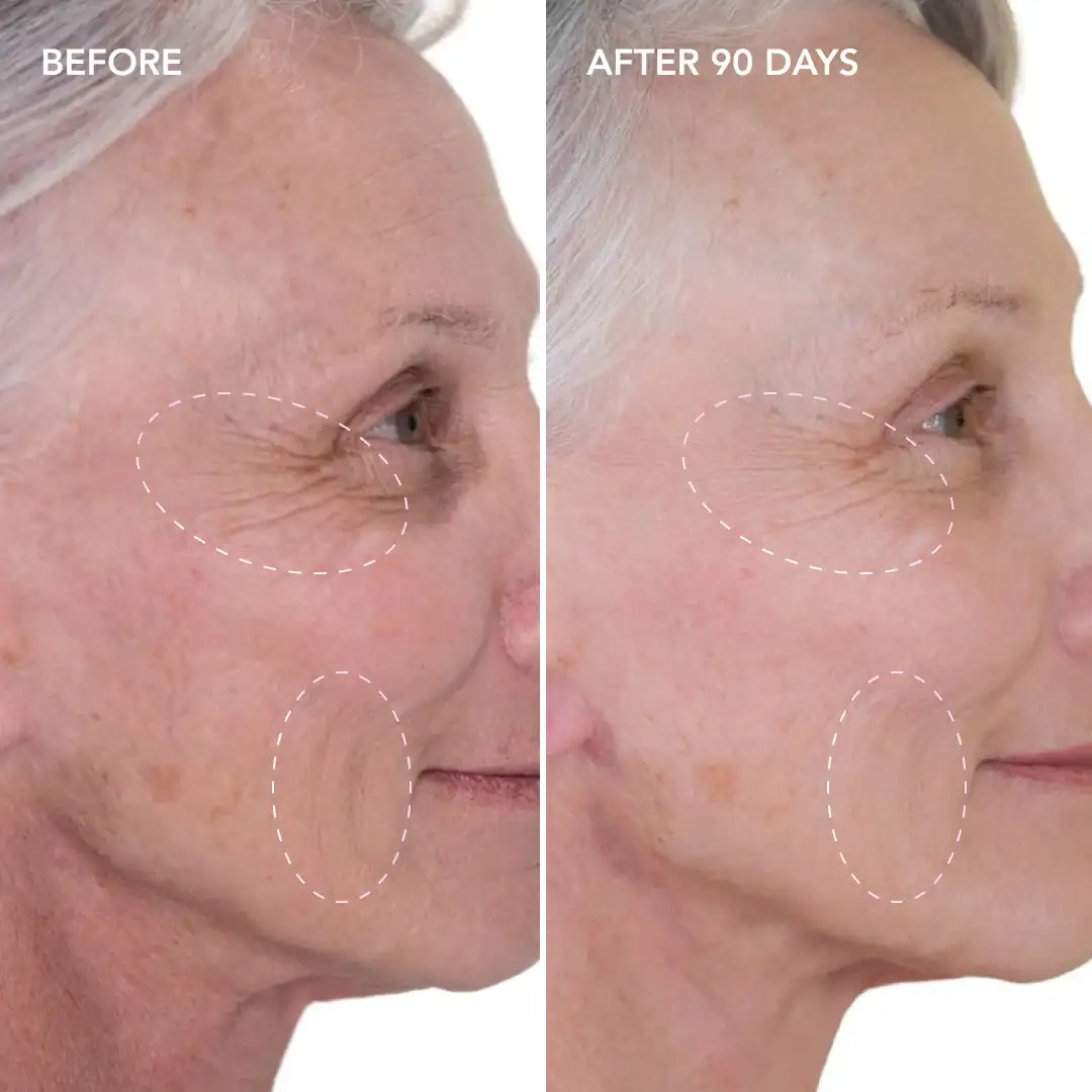 When will you see results Orpington